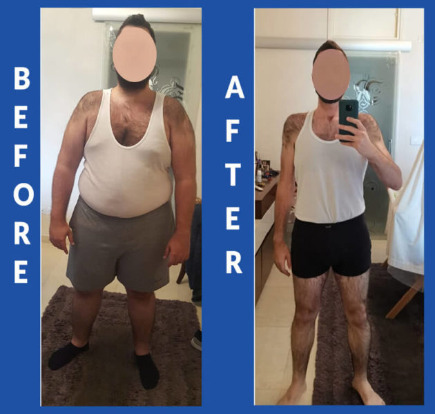 https://www.hsmc.ae/wp-content/uploads/2022/11/Gastric-Bypass-Surgery-before-after.jpg